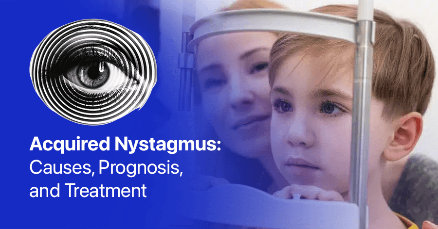 Acquired Nystagmus