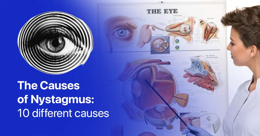 nystagmus causes