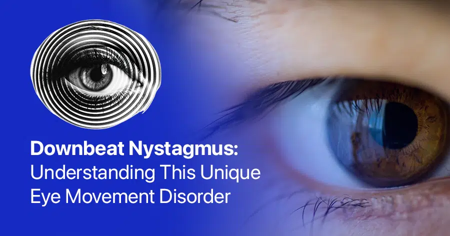 what is downbeat nystagmus