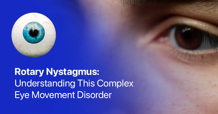 what is rotary nystagmus