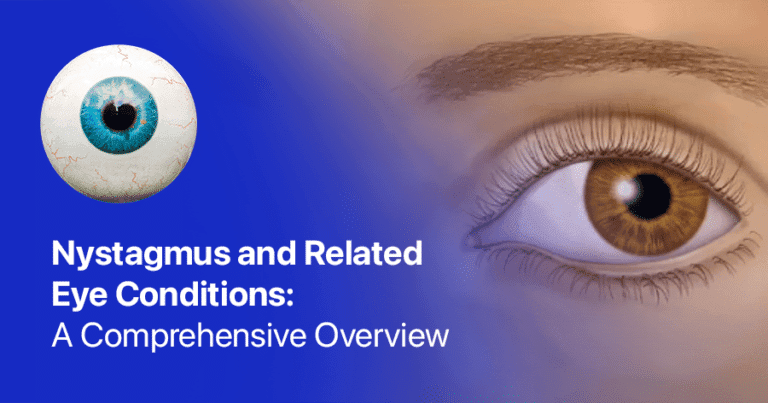 Nystagmus vs Strabismus: Expert Guide to Eye Movement Disorders