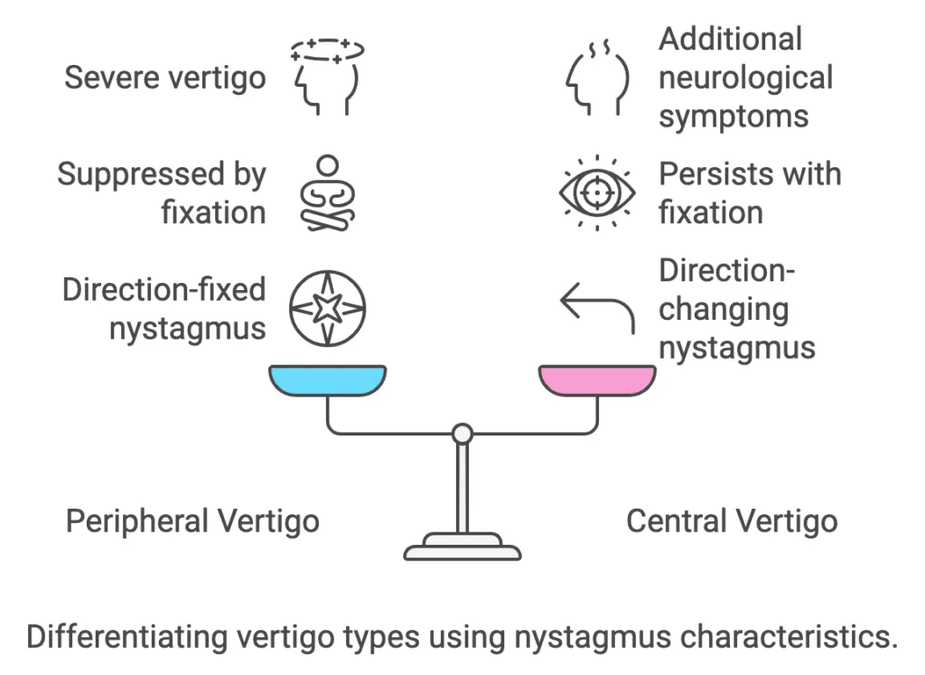 Differentiating Between Peripheral and Central Vertigo Using Nystagmus