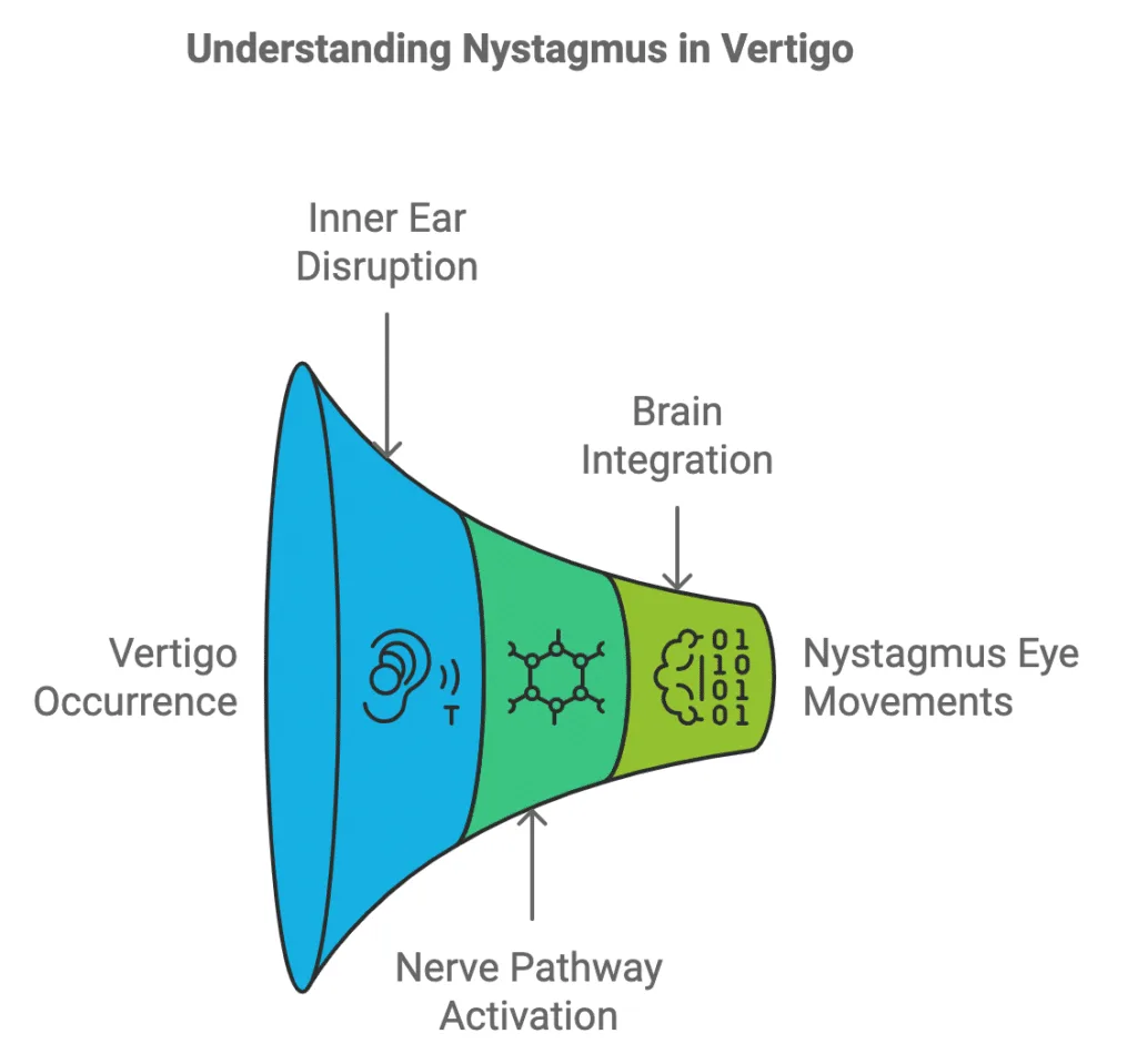 understanding nystagmus in vertigo