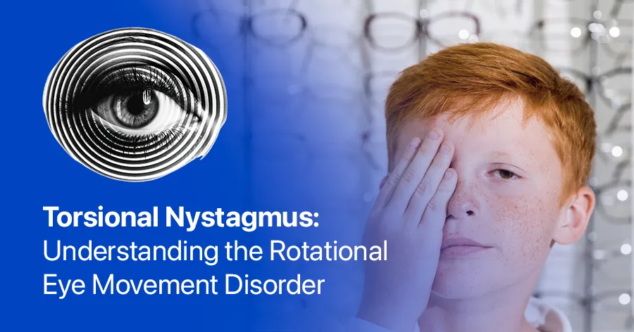 Torsional nystagmus