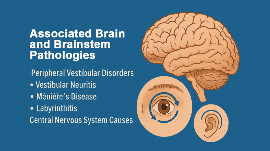 Nystagmus and brain pathologies