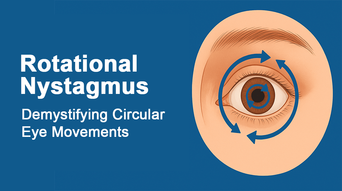 rotational nystagmus Article by dr.astrid larsen
